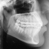 Radiologia Odontológica em Jequié